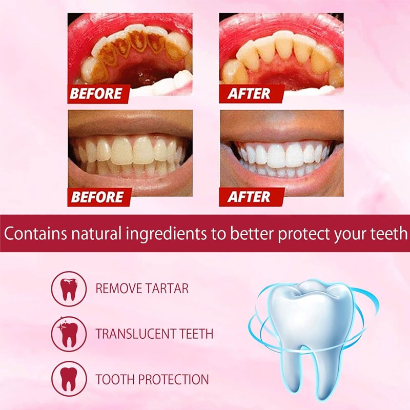 Sp-4 Teeth Whitening Toothpaste